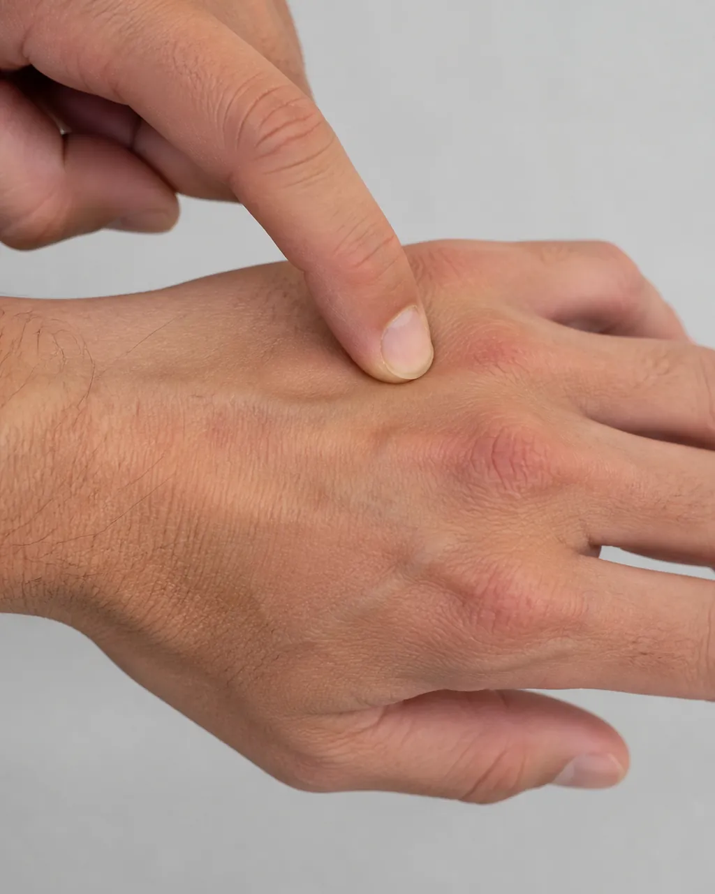Finger locating Luo Zhen 落枕穴 on the dorsum of the hand