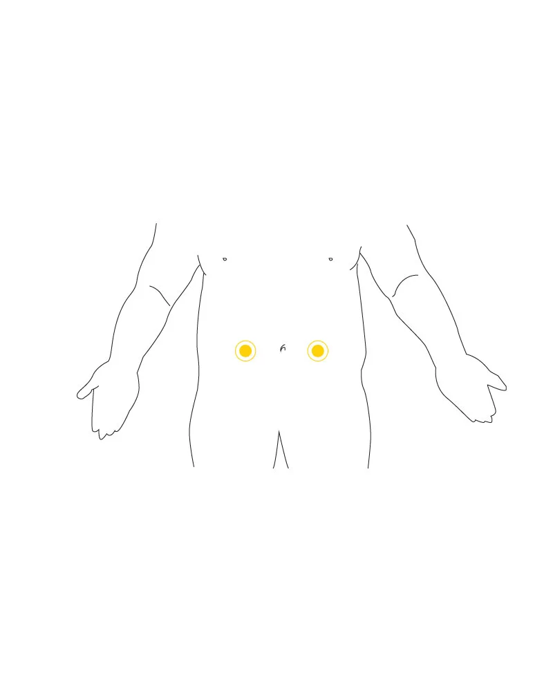 Hands locating Tian Shu ST25 beside a child's navel
