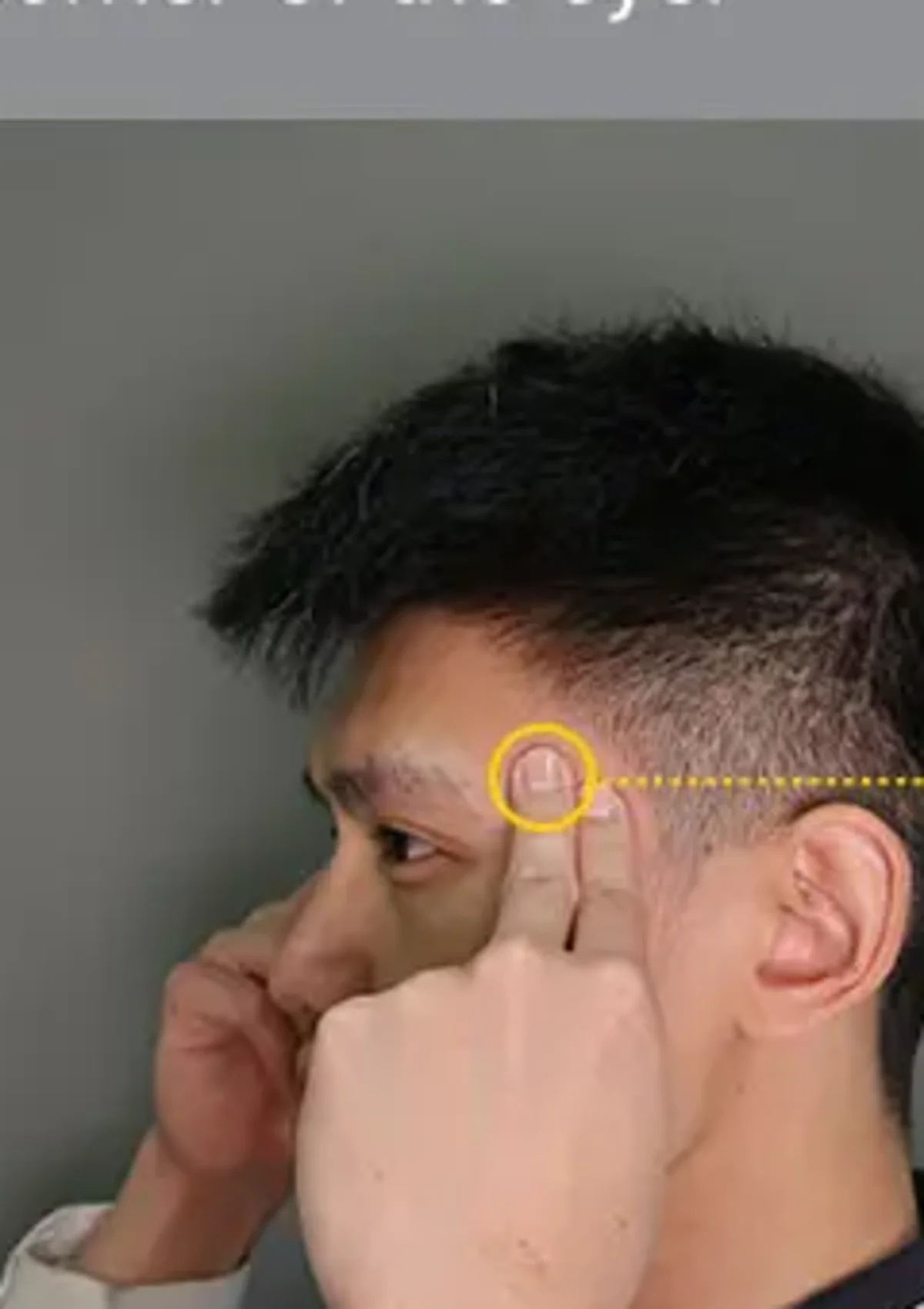 Fingers pressing Tai Yang EX-HN5 at the temple for post-vaccination headache
