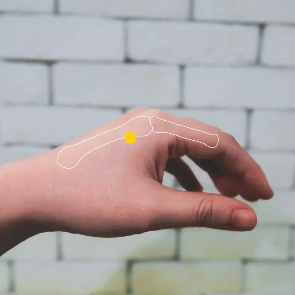 Index finger showing San Jian LI3 marked with a yellow dot on the radial border proximal to the second knuckle, with a white bone outline