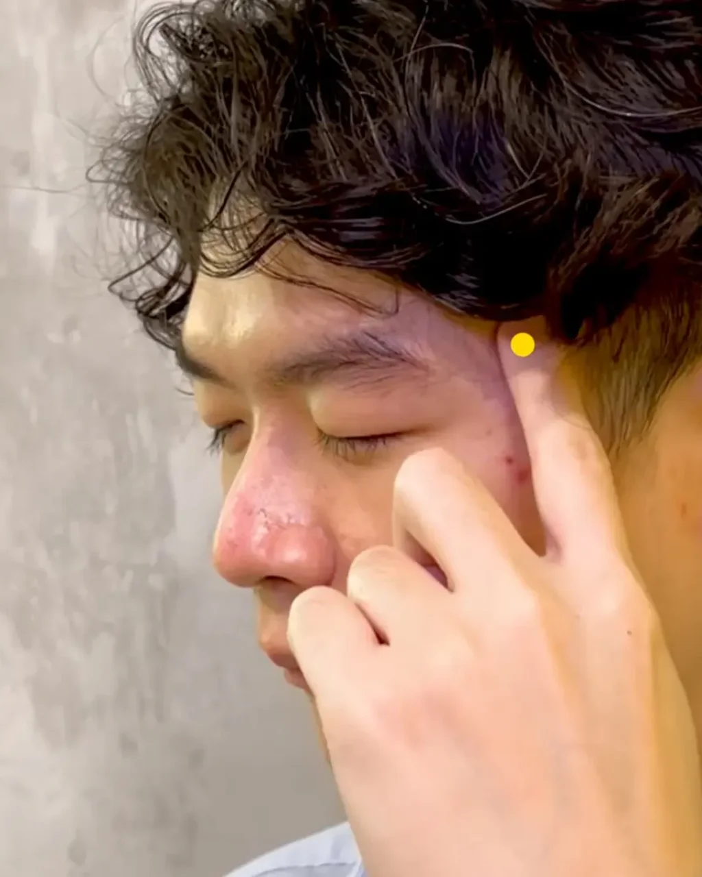 Index finger pointing to Tai Yang EX-HN5 at the temple, marked with a yellow dot behind the outer eyebrow and eye corner