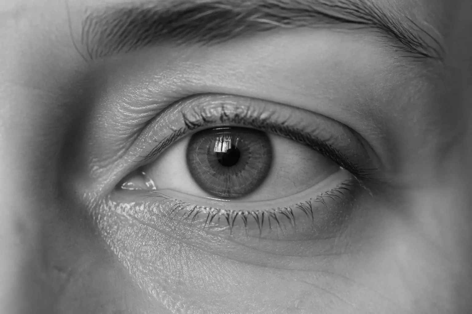 Close-up of a dry irritated eye for TCM dry eyes care