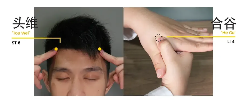 Diagram locating Tou Wei ST8 at the hairline and He Gu LI4 in the hand webbing