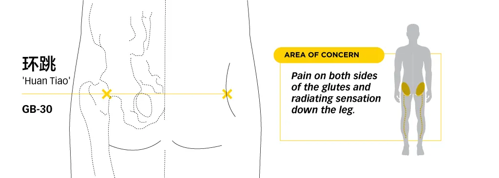 Line diagram locating Huantiao GB30 on the hip and buttock