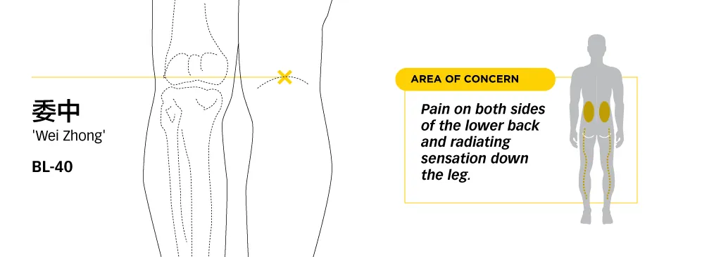 Line diagram locating Weizhong BL40 in the crease behind the knee