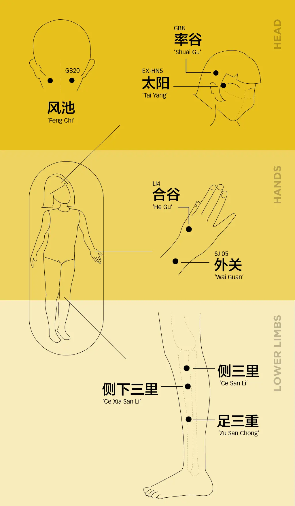 Teaching diagram of paediatric migraine acupressure points on the head, hands, and lower limbs