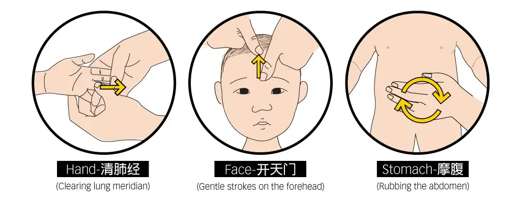 Teaching diagram of three paediatric Tuina strokes: qing fei jing on the hand, kai tian men on the forehead, and mo fu on the abdomen