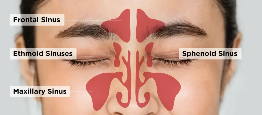 Diagram of frontal, ethmoid, sphenoid, and maxillary sinus cavities on the face