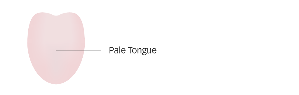 Diagram of a pale tongue with little coating for Blood deficiency