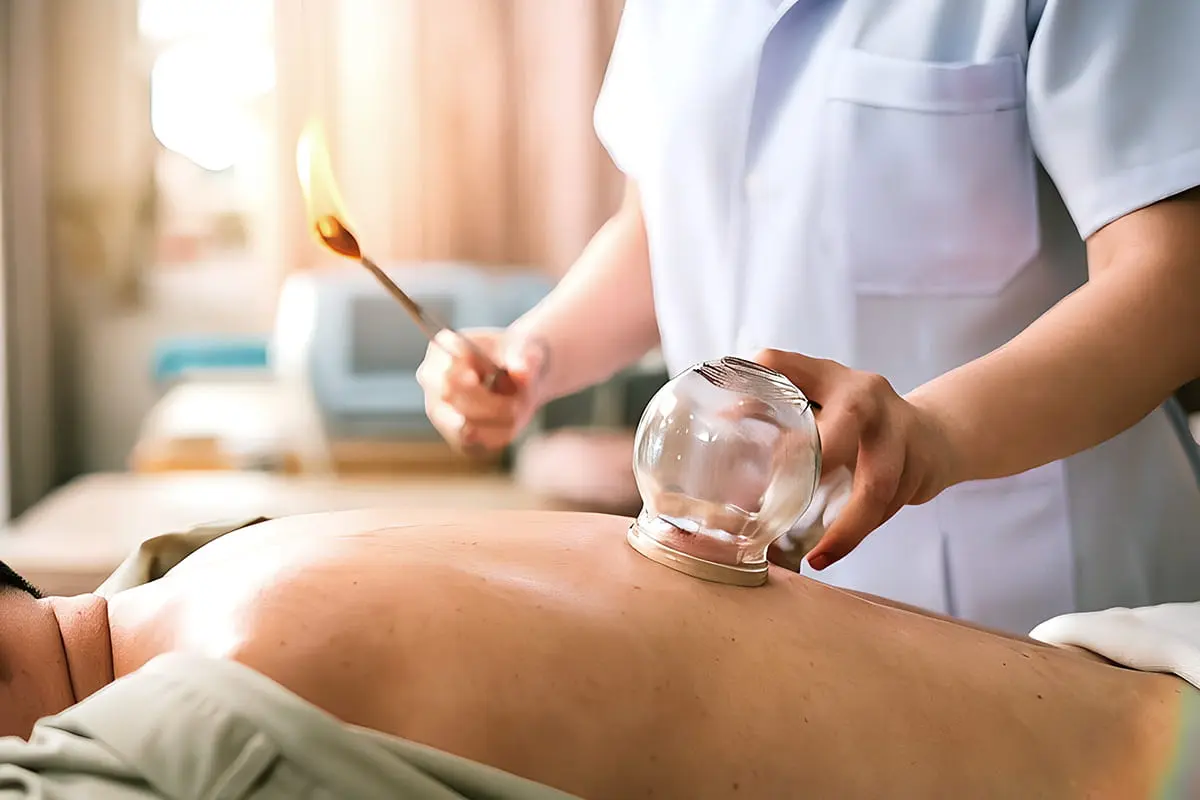 Therapeutic cupping for circulation support at PULSE TCM