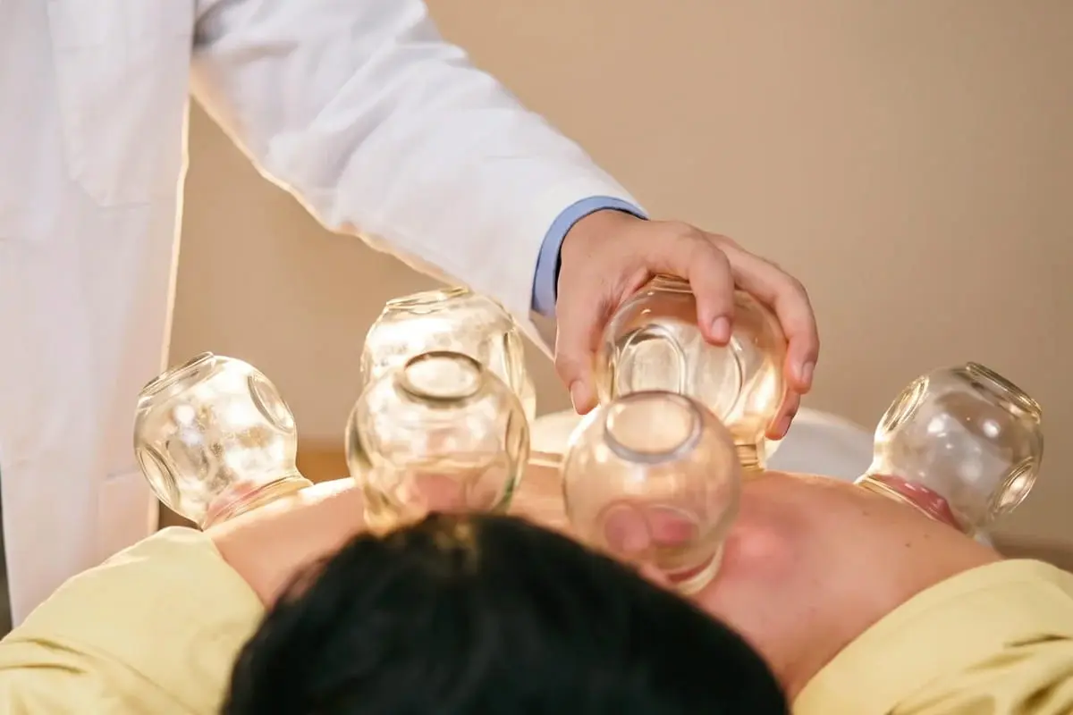 Therapeutic cupping used when indicated in hair-loss care