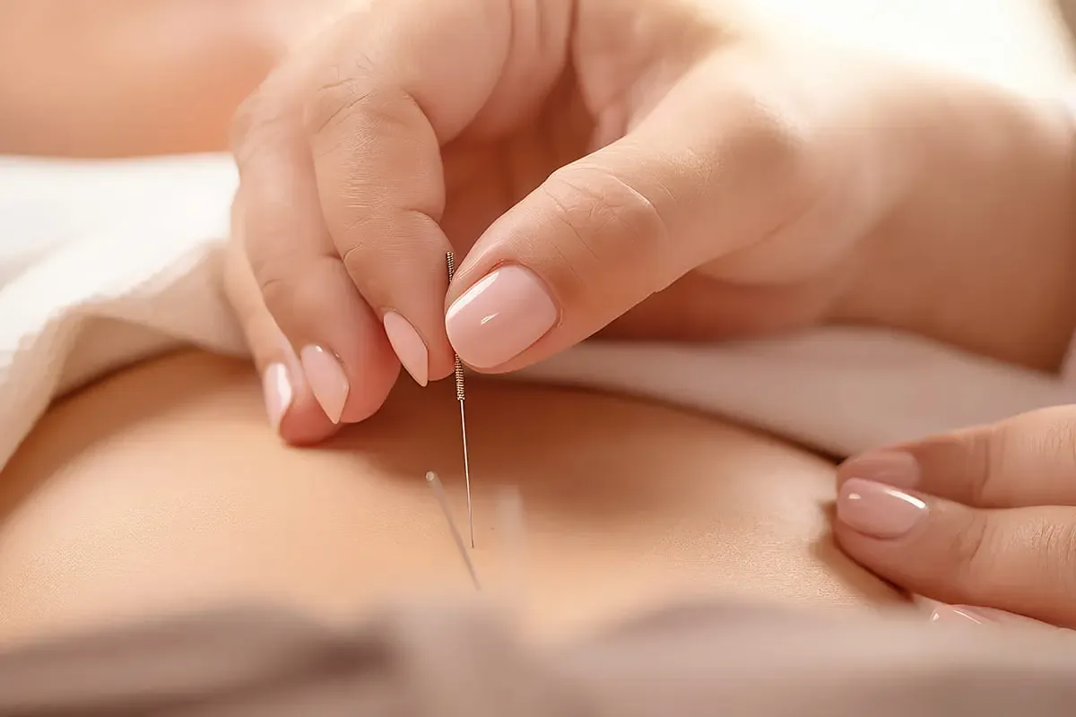 Meridian activation acupuncture in the MR12 metabolic reset