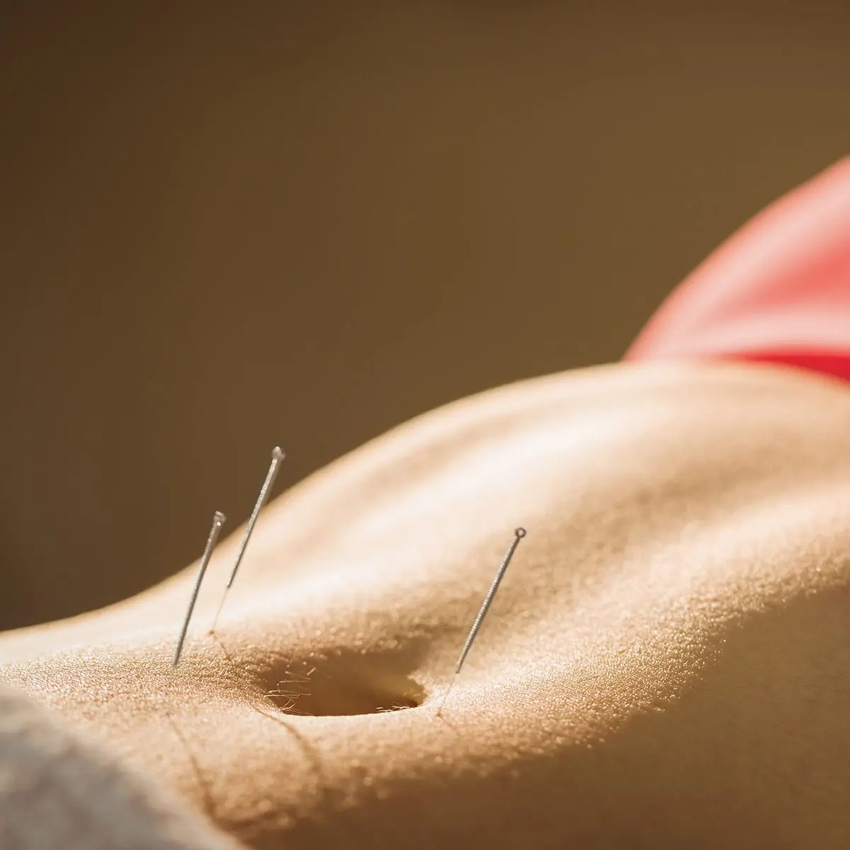Abdominal acupuncture for weight-management care at PULSE TCM