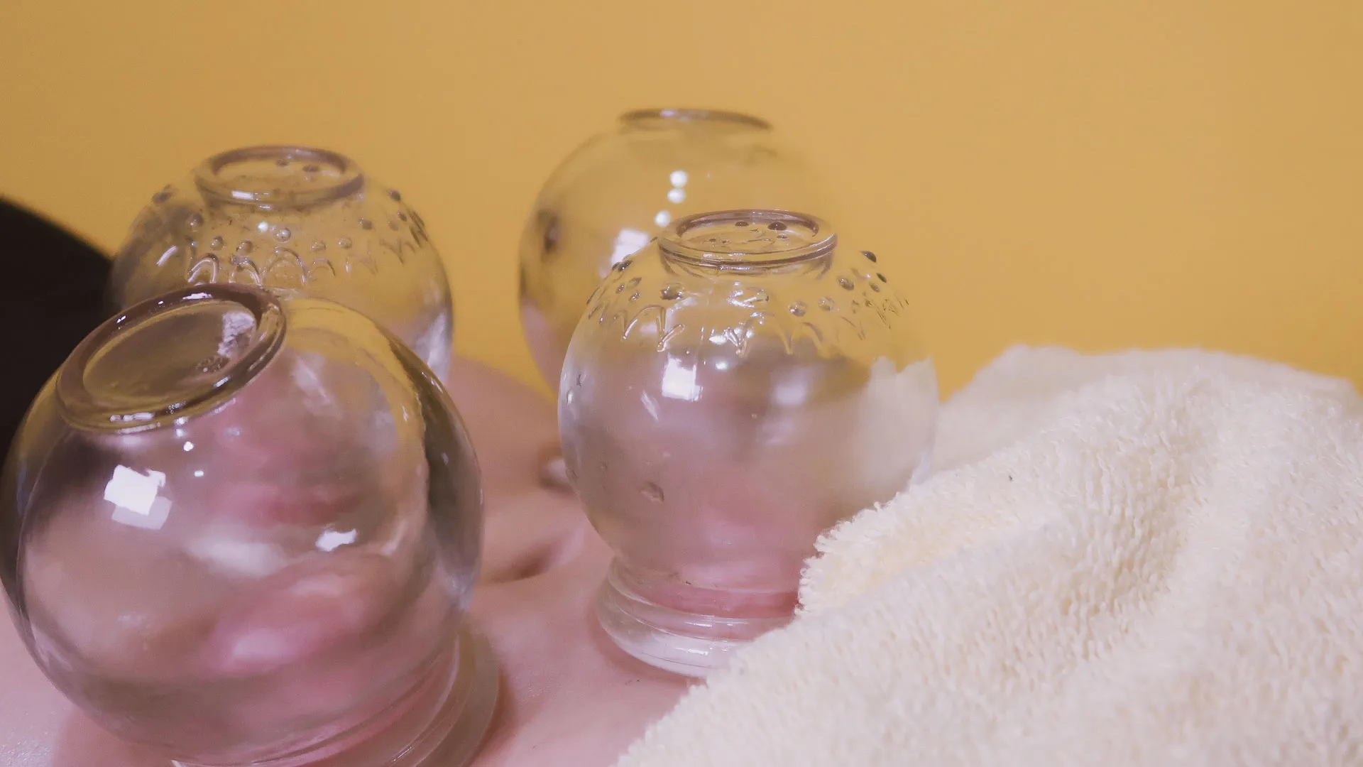 Cupping therapy in a calm PULSE TCM treatment room